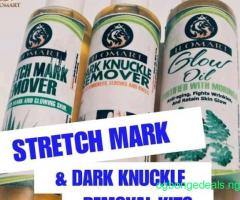 Strech mark kits