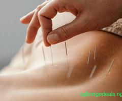 Acupuncture for joint, muscle, nerves
